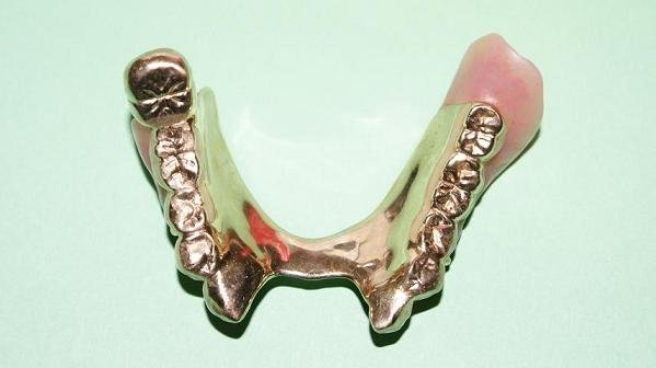 特殊精密義歯